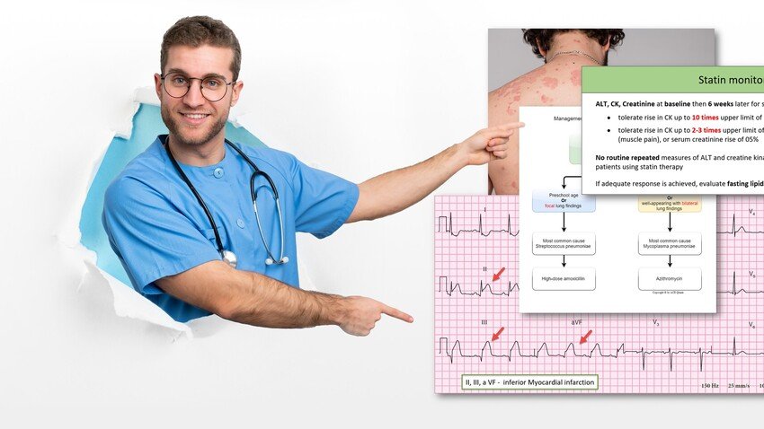 A man is pointing to an image of Ace QBank features while preparing to pass the MCCQE1 exam.